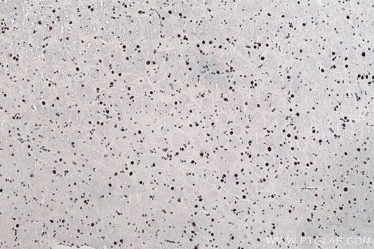 Immunohistochemistry (IHC) staining of rat cerebellum tissue using DACH1 Monoclonal antibody (60082-1-Ig)