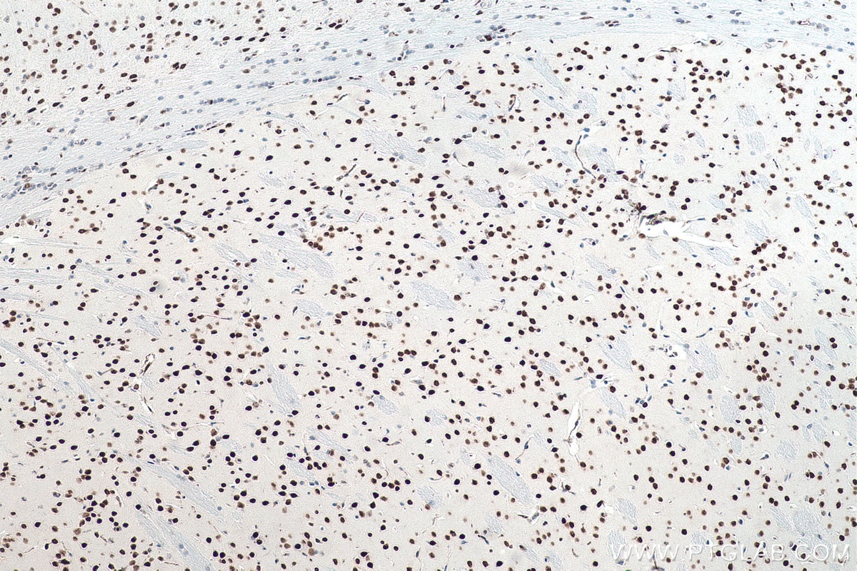 Immunohistochemistry (IHC) staining of mouse brain tissue using DACH1 Monoclonal antibody (60082-1-Ig)