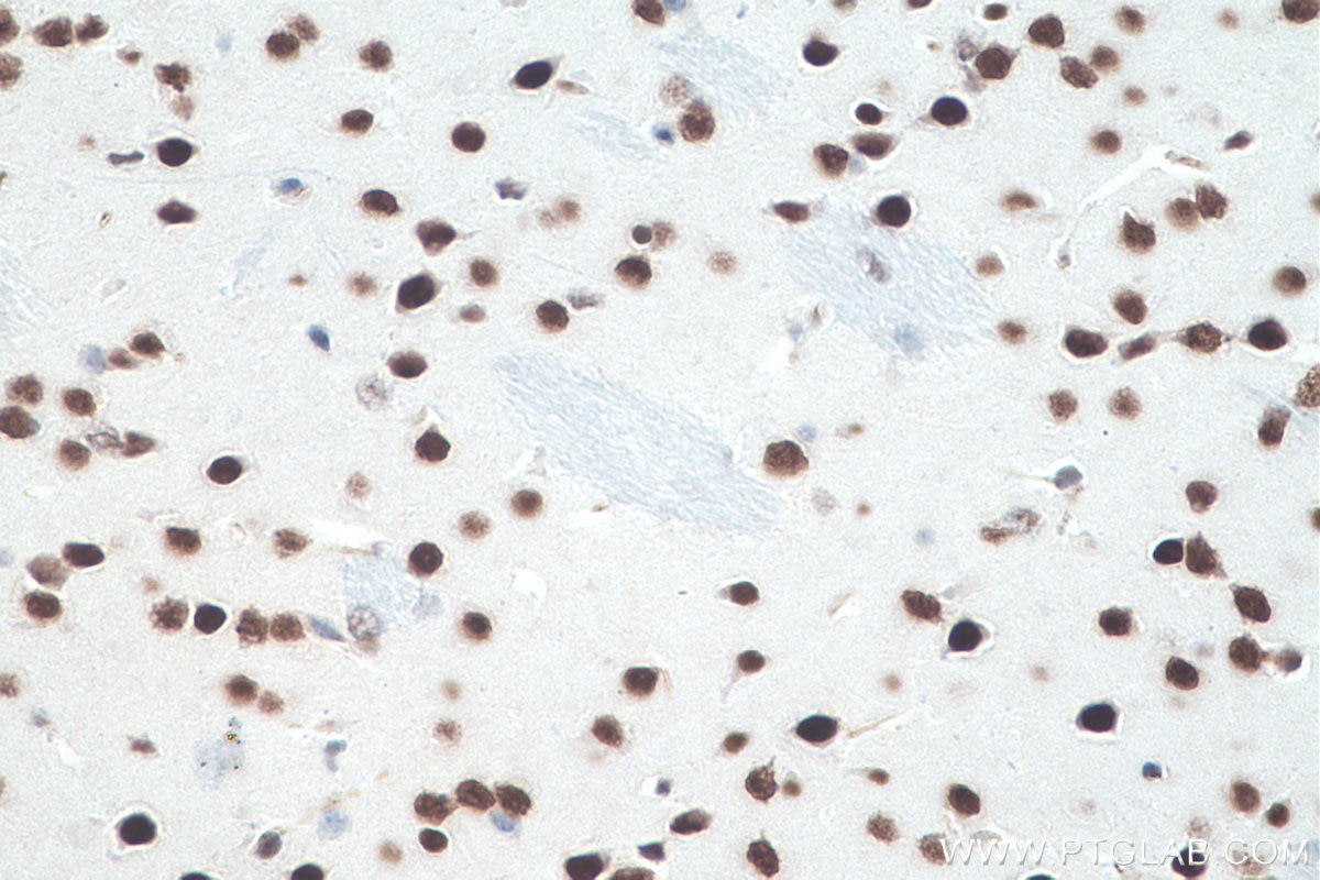 Immunohistochemistry (IHC) staining of mouse brain tissue using DACH1 Monoclonal antibody (60082-1-Ig)