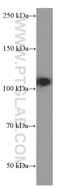 Western Blot (WB) analysis of ROS1728 cells using DACH1 Monoclonal antibody (60082-1-Ig)