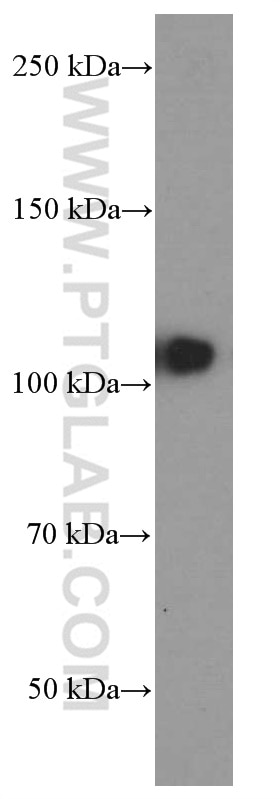 WB analysis of MCF-7 using 60082-1-Ig