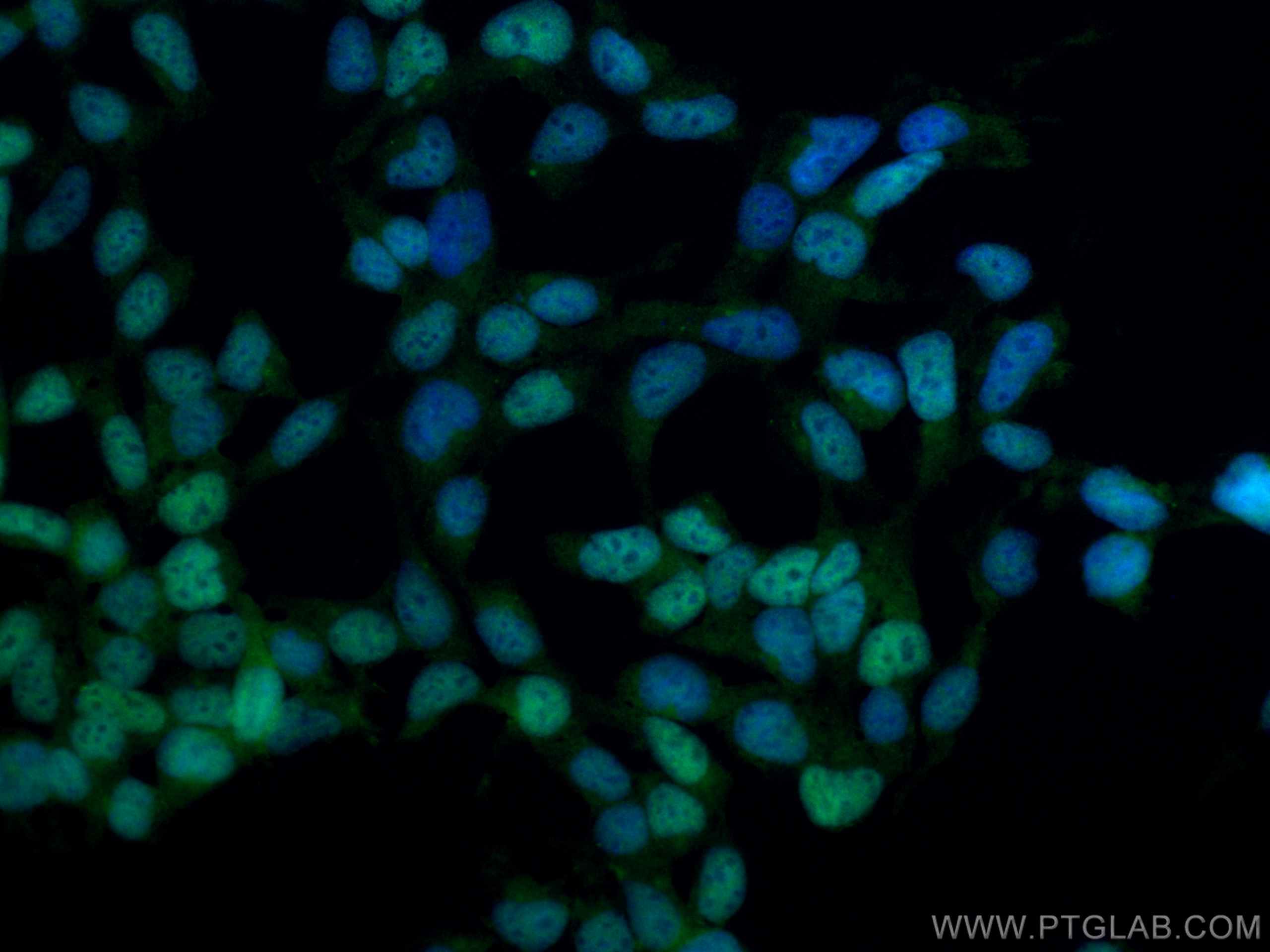 Immunofluorescence (IF) / fluorescent staining of HEK-293 cells using CoraLite® Plus 488-conjugated DACH1 Polyclonal ant (CL488-10914)