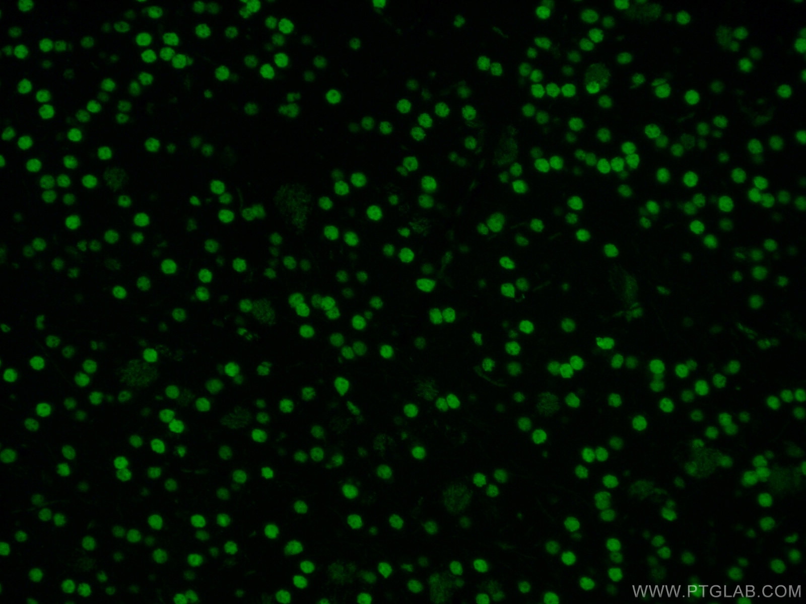 Immunofluorescence (IF) / fluorescent staining of mouse brain tissue using CoraLite® Plus 488-conjugated DACH1 Monoclonal ant (CL488-60082)