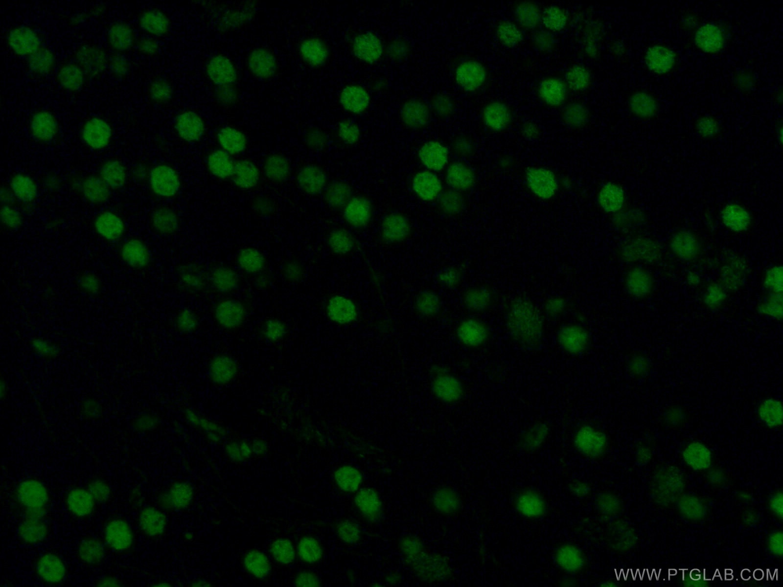 Immunofluorescence (IF) / fluorescent staining of mouse brain tissue using CoraLite® Plus 488-conjugated DACH1 Monoclonal ant (CL488-60082)