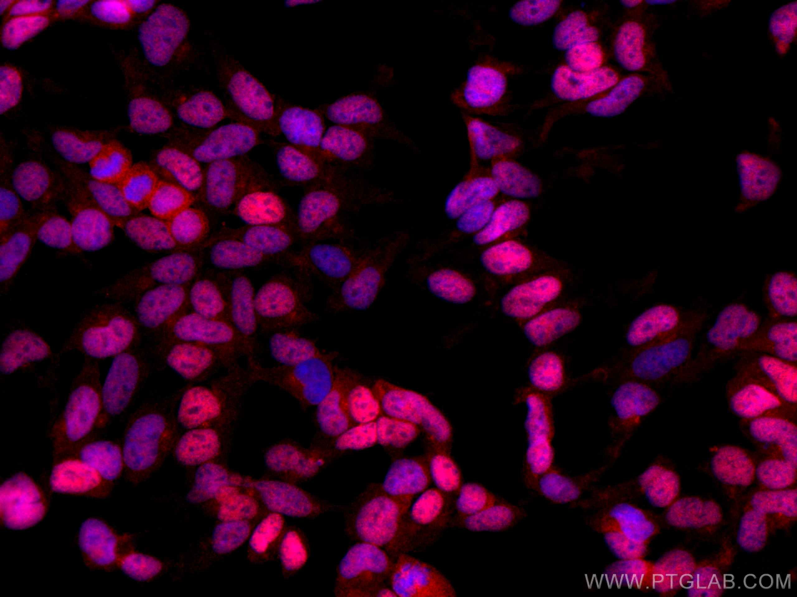 Immunofluorescence (IF) / fluorescent staining of HEK-293 cells using CoraLite®594-conjugated DACH1 Polyclonal antibody (CL594-10914)