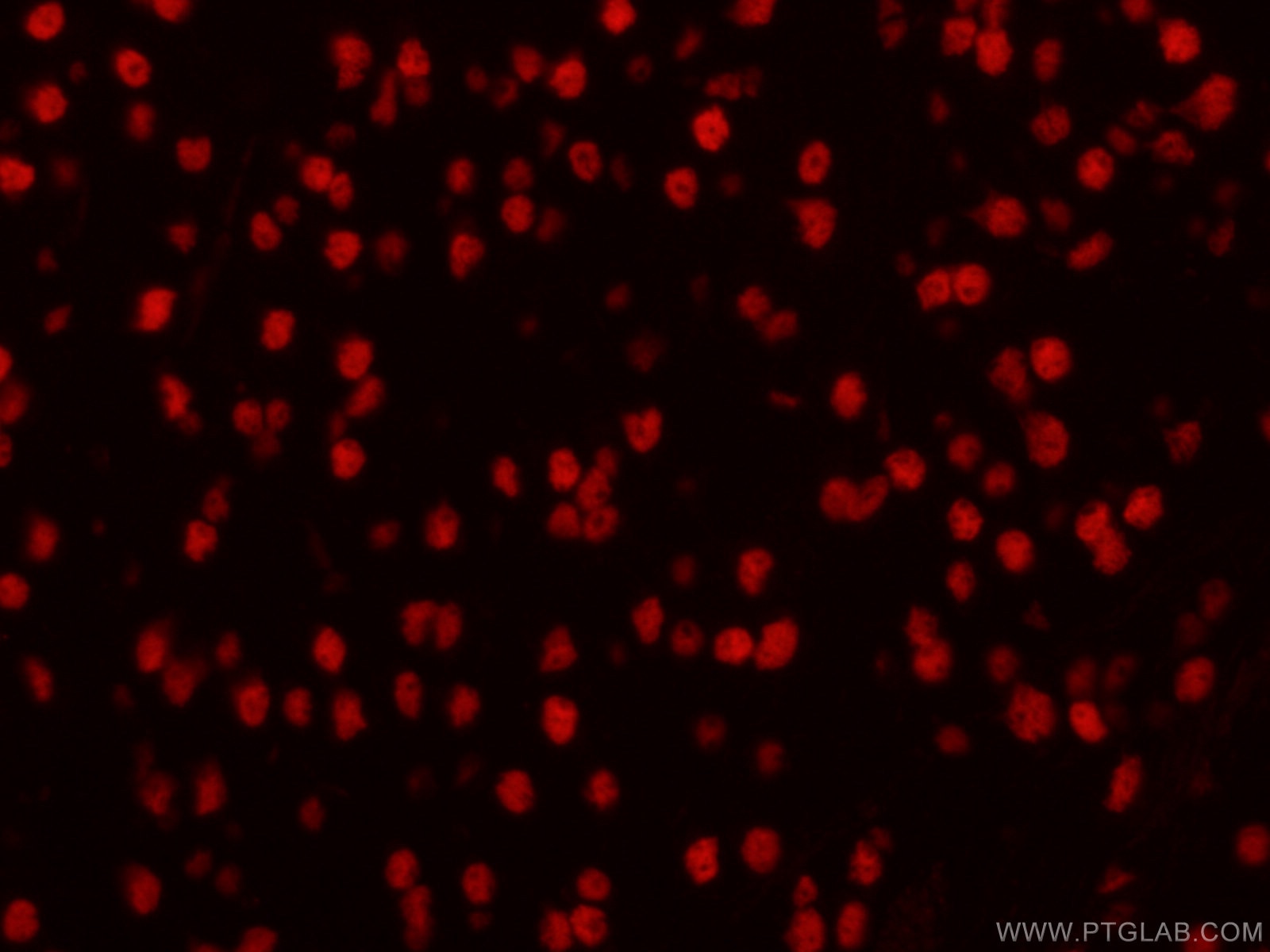 Immunofluorescence (IF) / fluorescent staining of mouse brain tissue using CoraLite®594-conjugated DACH1 Monoclonal antibody (CL594-60082)
