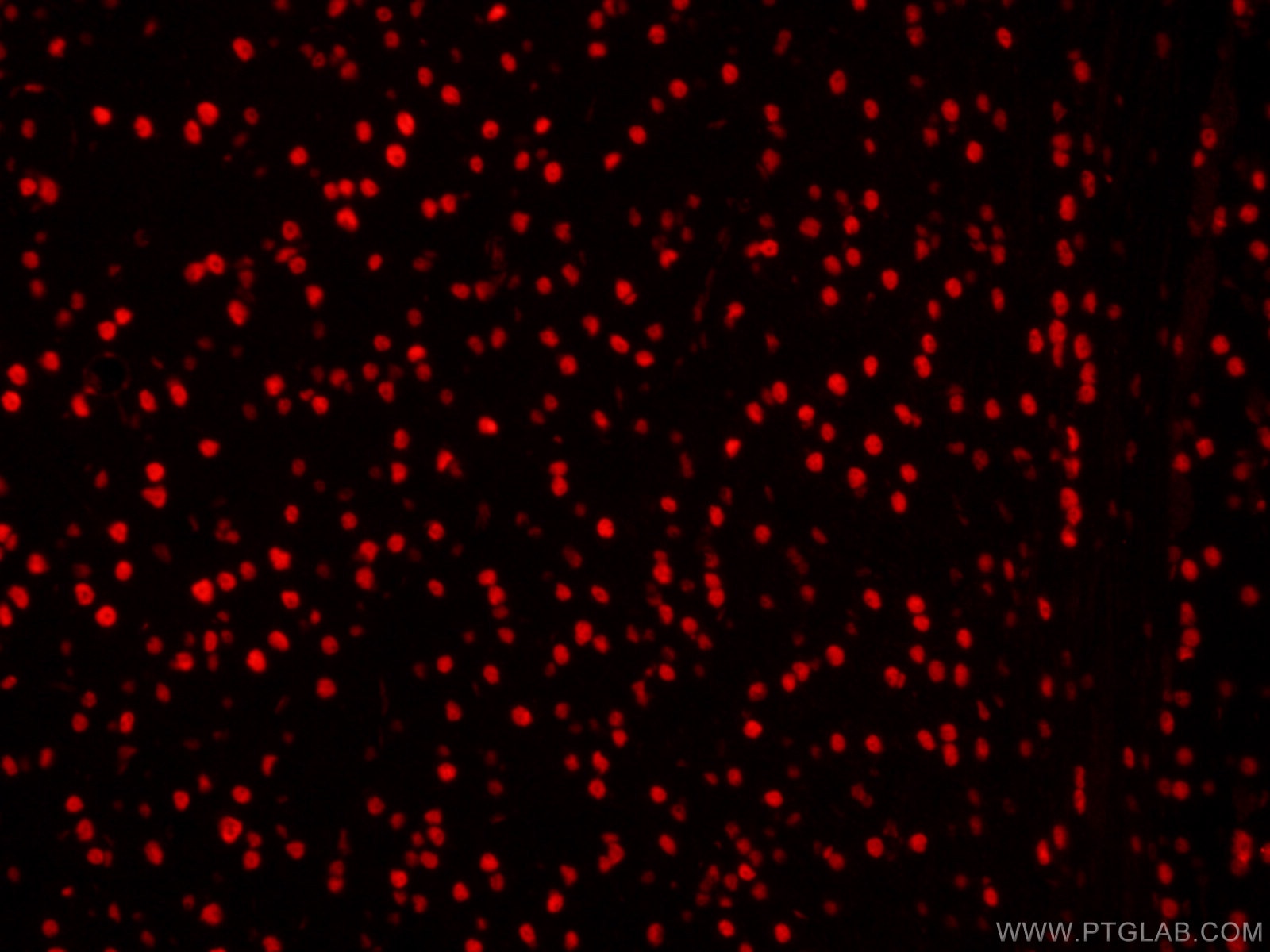 Immunofluorescence (IF) / fluorescent staining of mouse brain tissue using CoraLite®594-conjugated DACH1 Monoclonal antibody (CL594-60082)