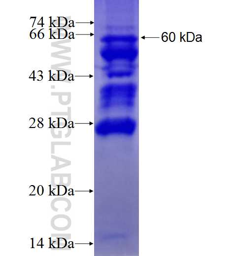 DACH1 fusion protein Ag1354 SDS-PAGE