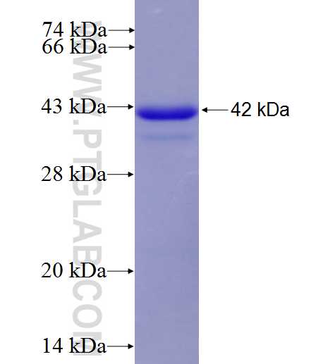 DACH1 fusion protein Ag4474 SDS-PAGE