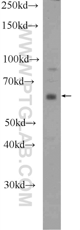 Western Blot (WB) analysis of NIH/3T3 cells using DACH2 Polyclonal antibody (25219-1-AP)