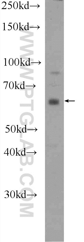 Western Blot (WB) analysis of NIH/3T3 cells using DACH2 Polyclonal antibody (25219-1-AP)