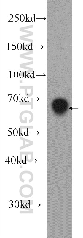 Western Blot (WB) analysis of mouse kidney tissue using DACH2 Polyclonal antibody (25219-1-AP)