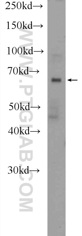 Western Blot (WB) analysis of mouse eye tissue using DACH2 Polyclonal antibody (25219-1-AP)