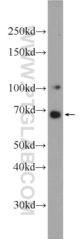Western Blot (WB) analysis of HeLa cells using DACH2 Polyclonal antibody (25219-1-AP)