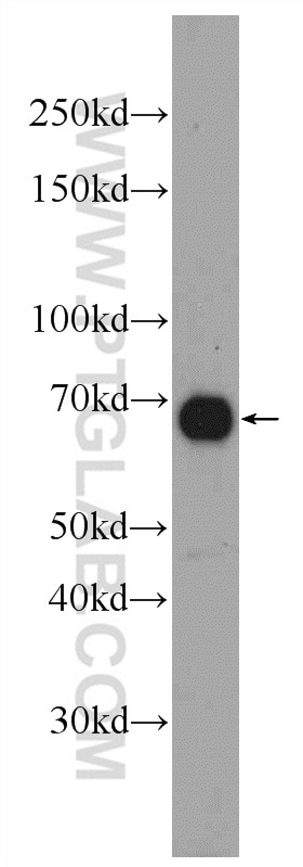 Western Blot (WB) analysis of mouse heart tissue using DACH2 Polyclonal antibody (25219-1-AP)