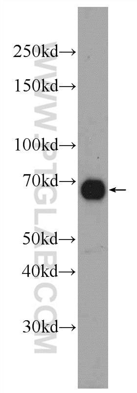 WB analysis of mouse heart using 25219-1-AP