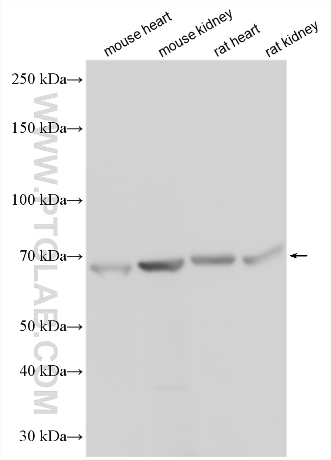 Western Blot (WB) analysis of various lysates using DACH2 Polyclonal antibody (25219-1-AP)