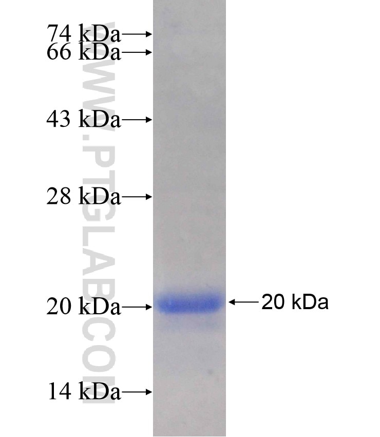 DACH2 fusion protein Ag18186 SDS-PAGE