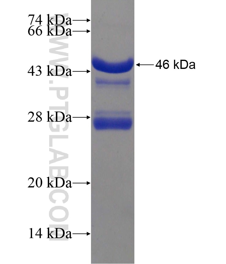 DACH2 fusion protein Ag18403 SDS-PAGE