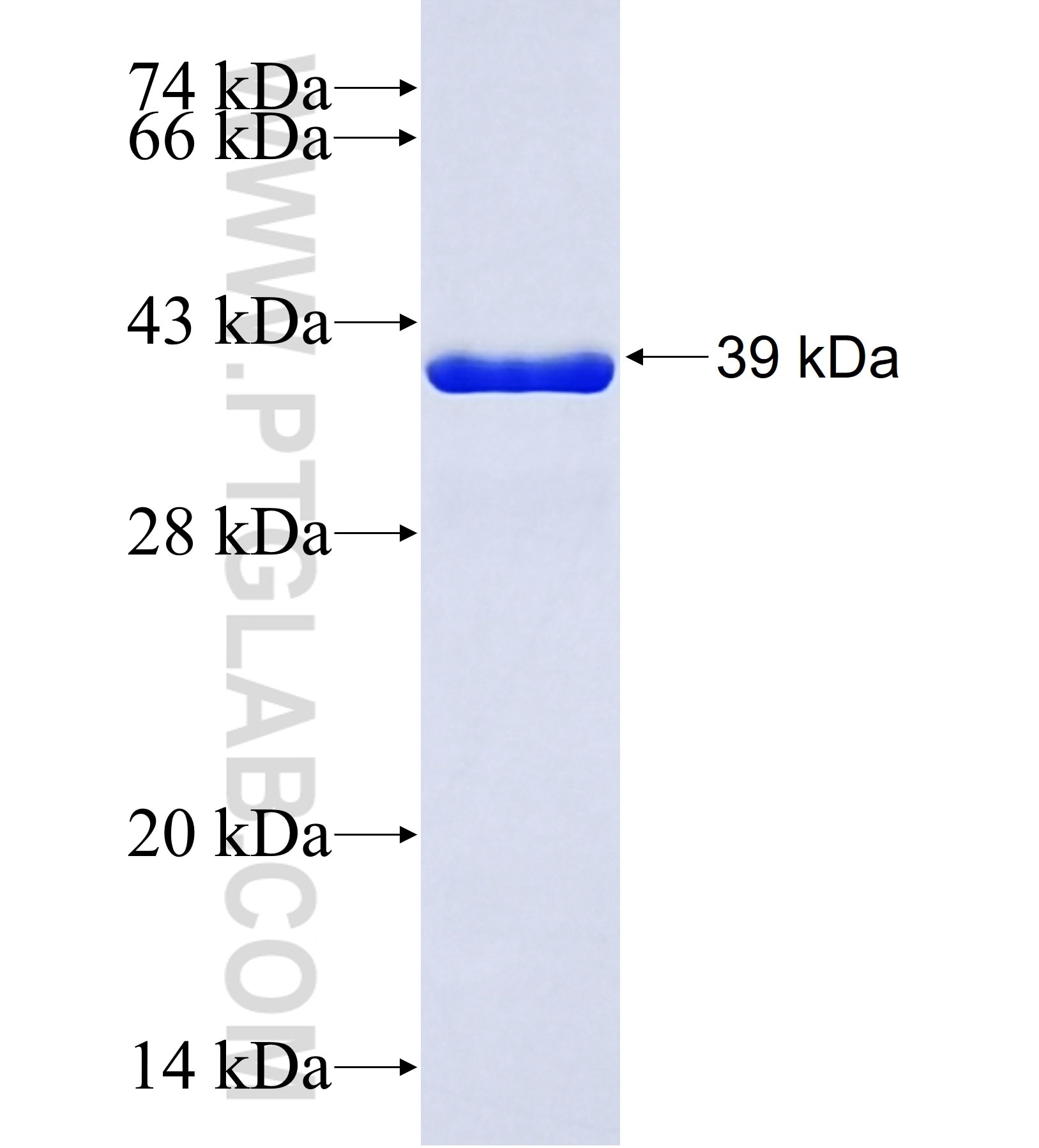 DACT2 fusion protein Ag41977 SDS-PAGE DACT2 fusion protein Ag41977 SDS-PAGE