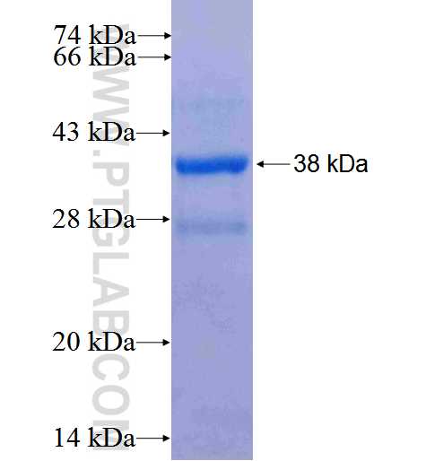 DAD1 fusion protein Ag0814 SDS-PAGE