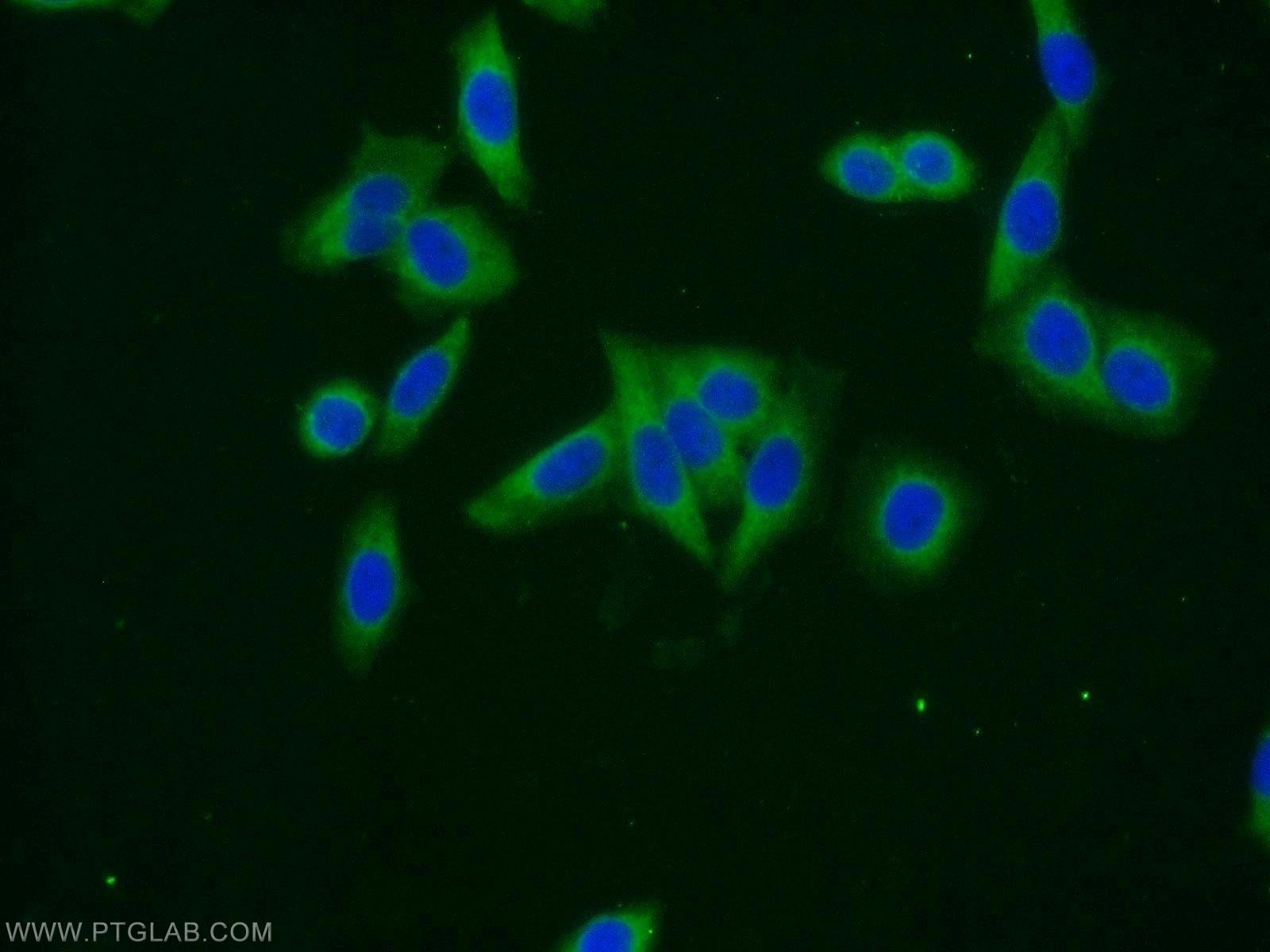 Immunofluorescence (IF) / fluorescent staining of HeLa cells using Dystroglycan Polyclonal antibody (11017-1-AP)