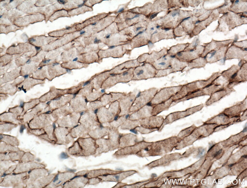 IHC staining of mouse heart using 11017-1-AP