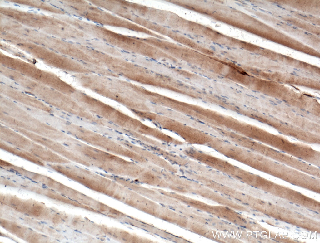 IHC staining of mouse skeletal muscle using 11017-1-AP