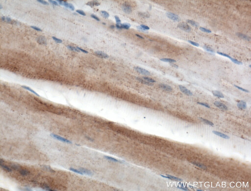 IHC staining of mouse skeletal muscle using 11017-1-AP