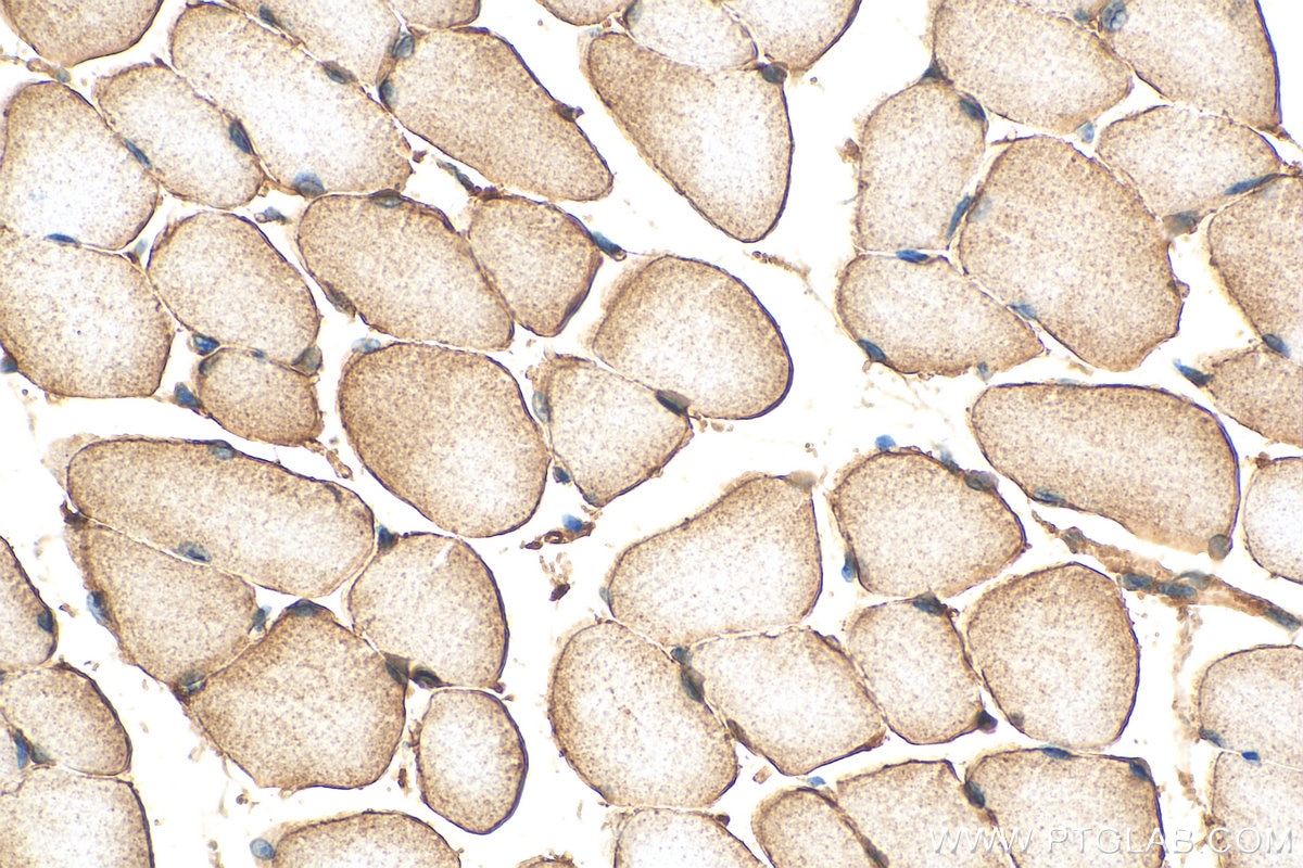 Immunohistochemistry (IHC) staining of mouse skeletal muscle tissue using Dystroglycan Polyclonal antibody (11017-1-AP)