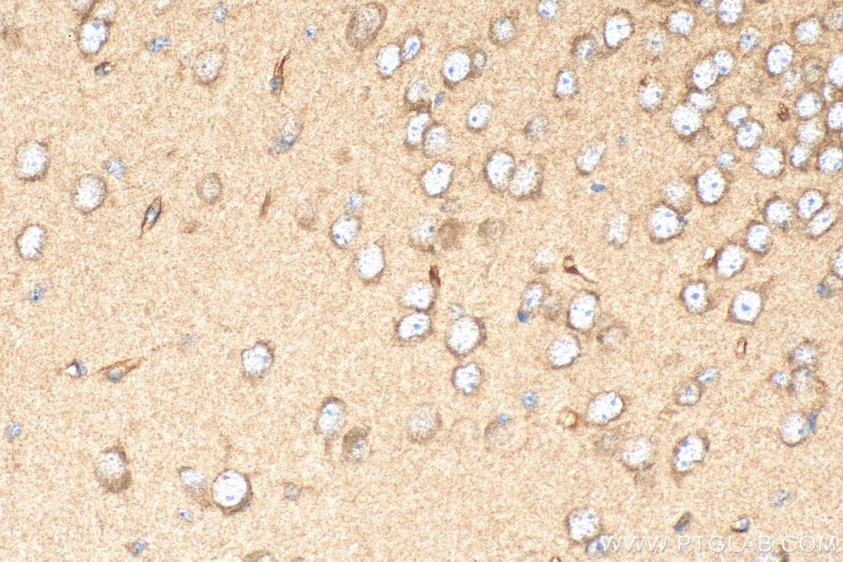 Immunohistochemistry (IHC) staining of mouse brain tissue using Dystroglycan Polyclonal antibody (11017-1-AP)