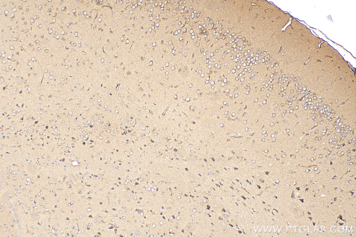 Immunohistochemistry (IHC) staining of mouse brain tissue using Dystroglycan Polyclonal antibody (11017-1-AP)