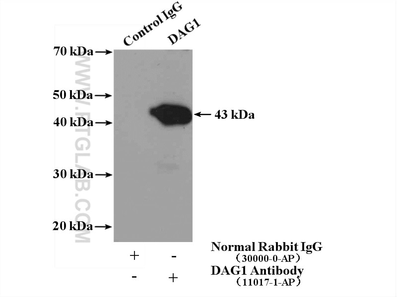 Immunoprecipitation (IP) experiment of mouse brain tissue using Dystroglycan Polyclonal antibody (11017-1-AP)