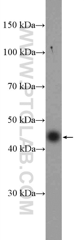 Western Blot (WB) analysis of mouse brain tissue using Dystroglycan Polyclonal antibody (11017-1-AP)