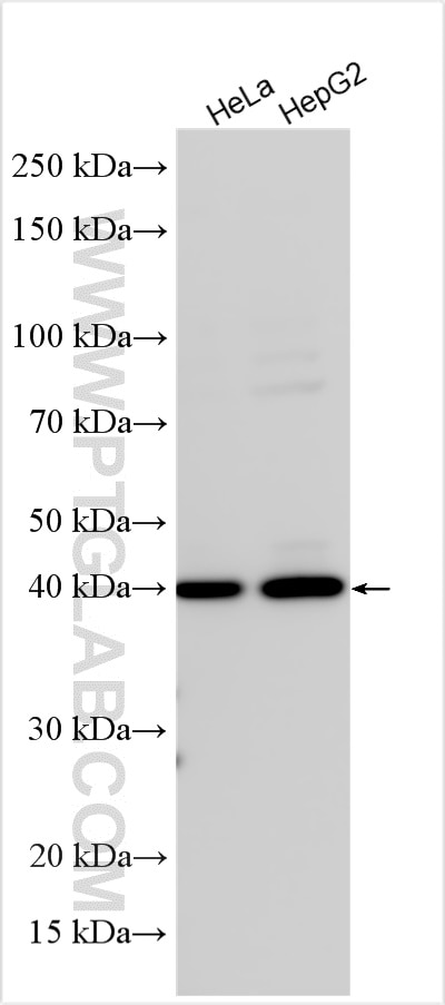 Western Blot (WB) analysis of various lysates using Dystroglycan Polyclonal antibody (11017-1-AP)