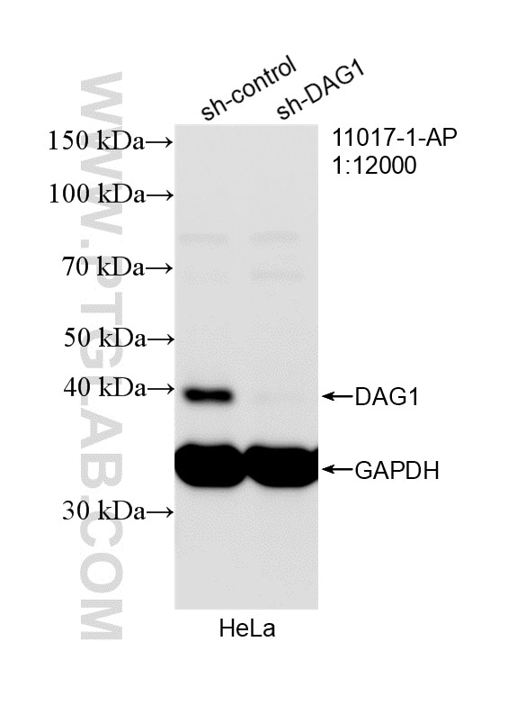 Western Blot (WB) analysis of HeLa cells using Dystroglycan Polyclonal antibody (11017-1-AP)