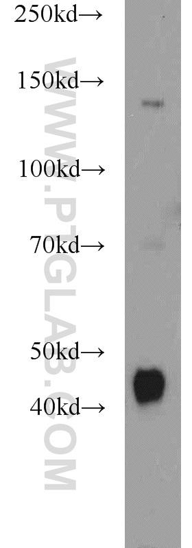 Western Blot (WB) analysis of mouse skeletal muscle tissue using Dystroglycan Polyclonal antibody (11017-1-AP)