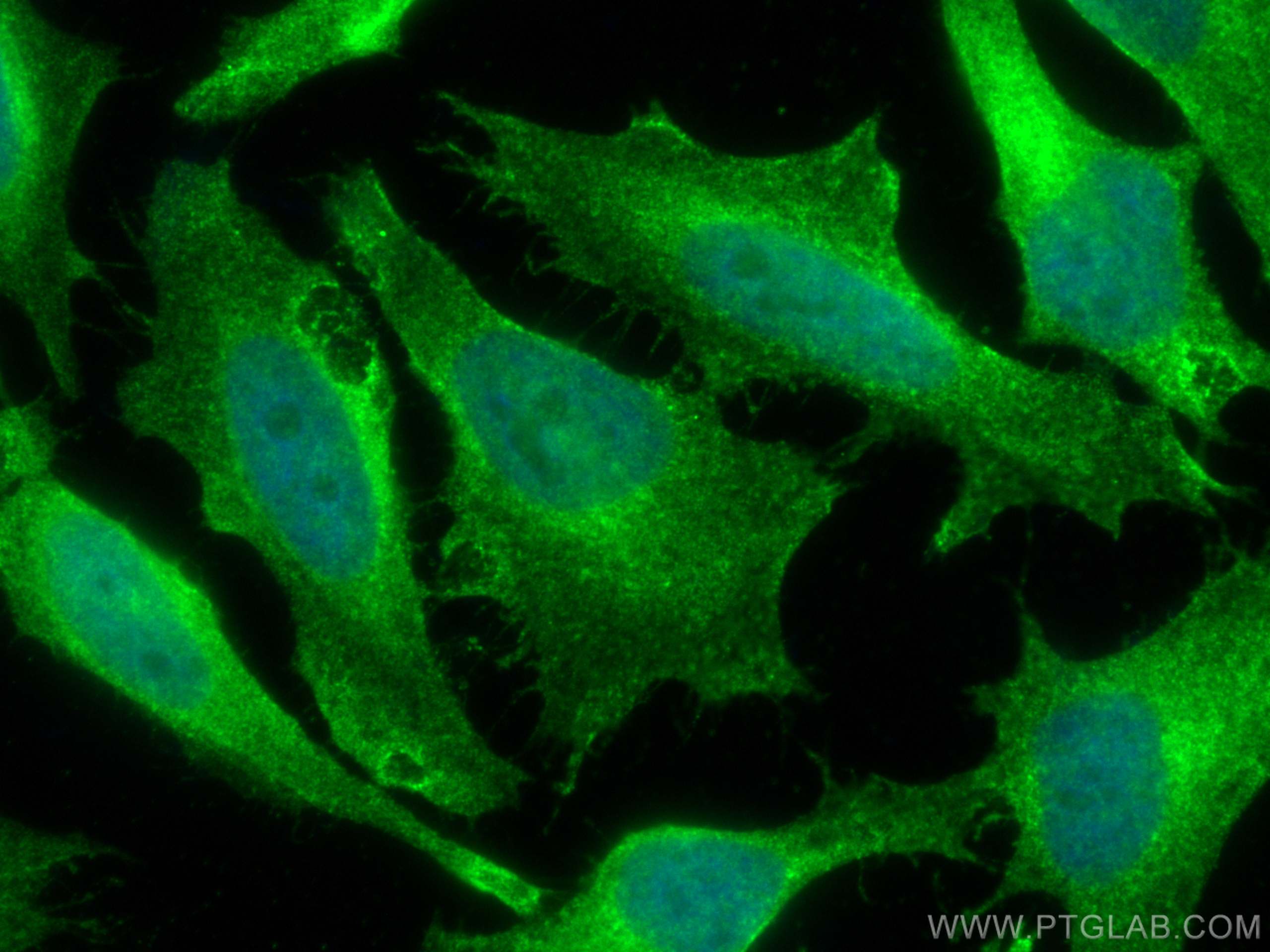 Immunofluorescence (IF) / fluorescent staining of HeLa cells using Dystroglycan Monoclonal antibody (66735-1-Ig)