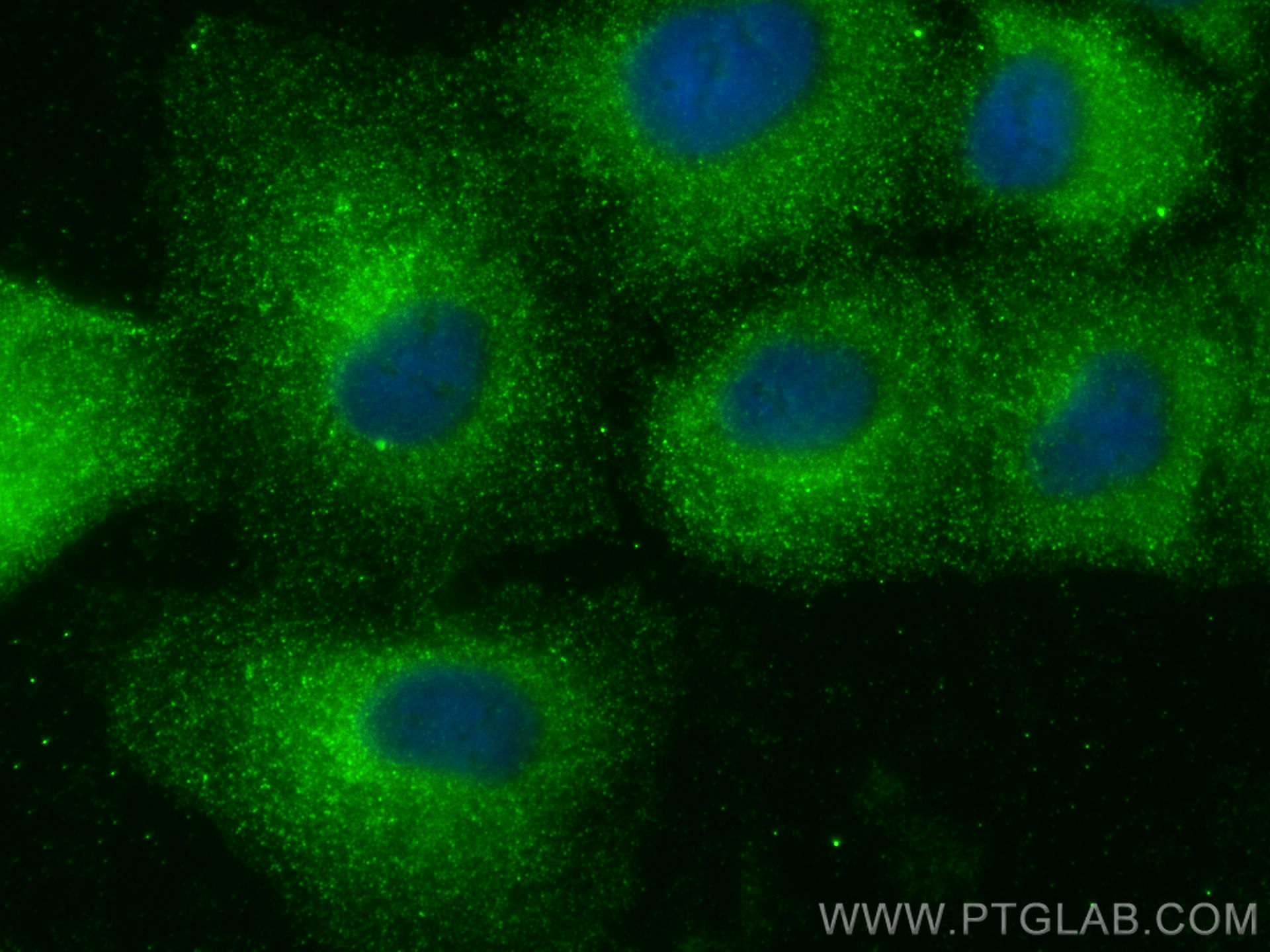 Immunofluorescence (IF) / fluorescent staining of A549 cells using Dystroglycan Monoclonal antibody (66735-1-Ig)