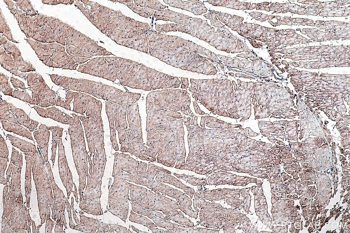 Immunohistochemistry (IHC) staining of rat heart tissue using Dystroglycan Monoclonal antibody (66735-1-Ig)