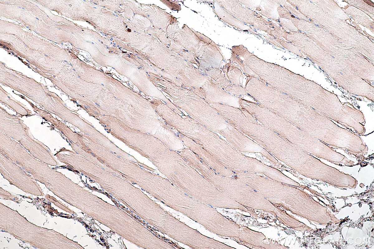 Immunohistochemistry (IHC) staining of rat skeletal muscle tissue using Dystroglycan Monoclonal antibody (66735-1-Ig)
