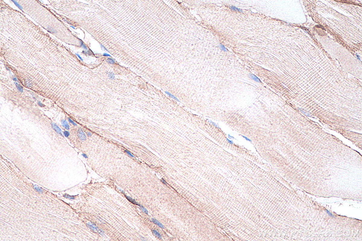 Immunohistochemistry (IHC) staining of rat skeletal muscle tissue using Dystroglycan Monoclonal antibody (66735-1-Ig)