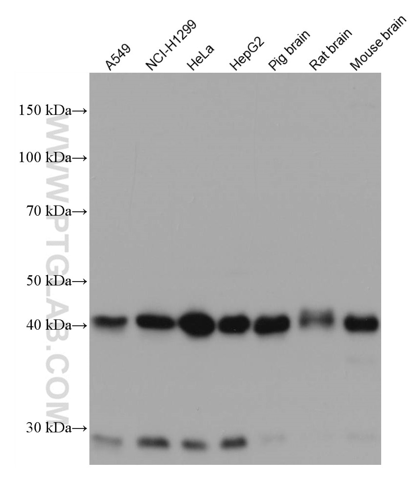 Western Blot (WB) analysis of various lysates using Dystroglycan Monoclonal antibody (66735-1-Ig)