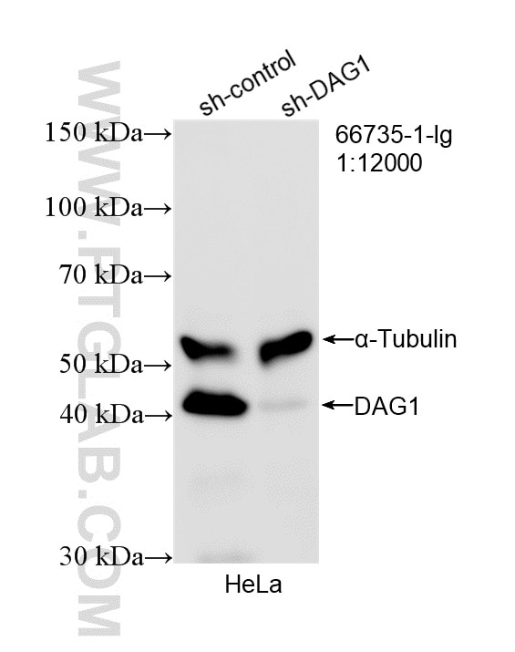 WB analysis of HeLa using 66735-1-Ig Western Blot (WB) analysis of HeLa cells using Dystroglycan Monoclonal antibody (66735-1-Ig)