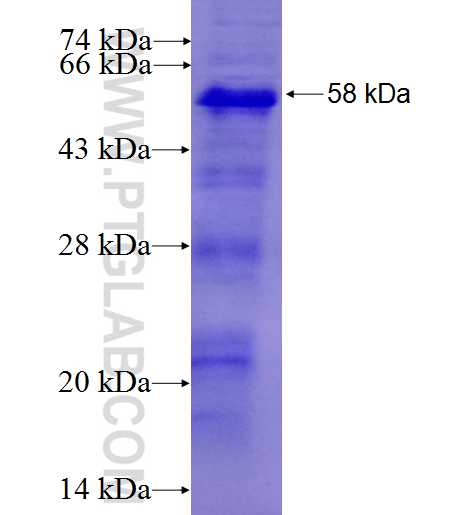 DAG1 fusion protein Ag27222 SDS-PAGE