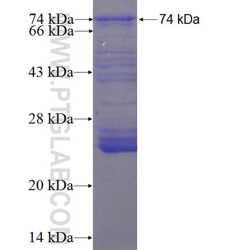 DAG1 fusion protein Ag1456 SDS-PAGE