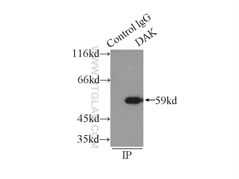 Immunoprecipitation (IP) experiment of HeLa cells using DAK Polyclonal antibody (12224-1-AP)