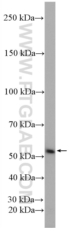 Western Blot (WB) analysis of HeLa cells using DAK Polyclonal antibody (12224-1-AP)