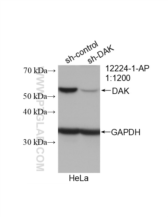 Western Blot (WB) analysis of HeLa cells using DAK Polyclonal antibody (12224-1-AP)