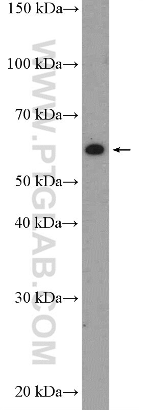 Western Blot (WB) analysis of HeLa cells using DAK Polyclonal antibody (12224-1-AP)